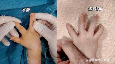 info-1242-699 info-1242-699